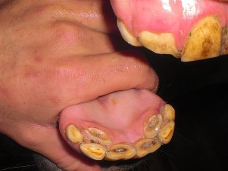 Deciduous Incisors - Before 