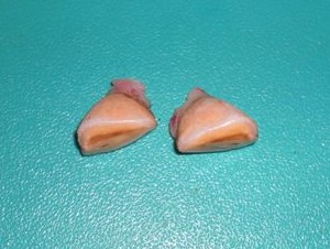 Deciduous Incisors - Extracted Teeth